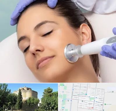 پلاسما جت در مرداویج اصفهان