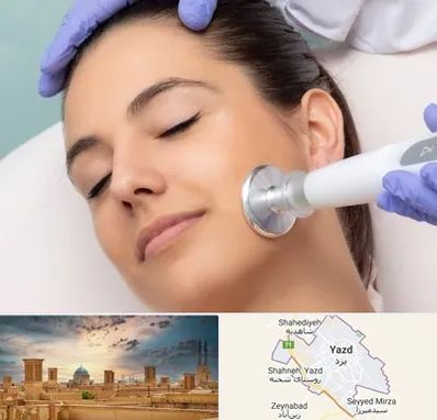 پلاسما جت در یزد