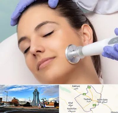 پلاسما جت در تایباد