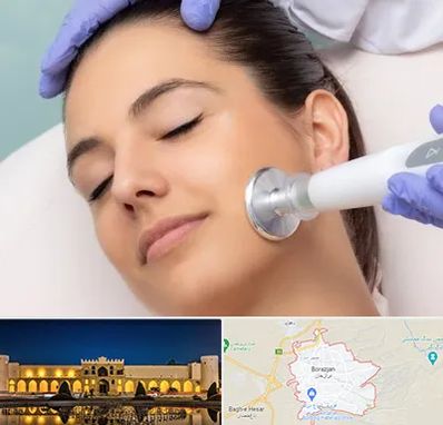 پلاسما جت در برازجان