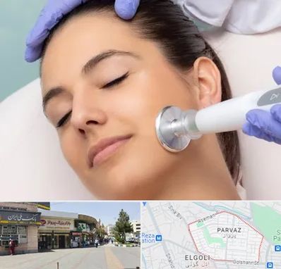 پلاسما جت در پرواز تبریز