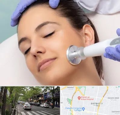 پلاسما جت در ظفر