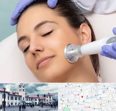 پلاسما جت در میدان شهرداری رشت