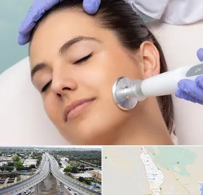 پلاسما جت در اندیمشک