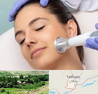 پلاسما جت در طالقان