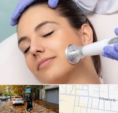 پلاسما جت در خیابان فلسطین