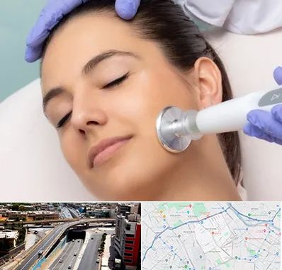 پلاسما جت در ستارخان شیراز