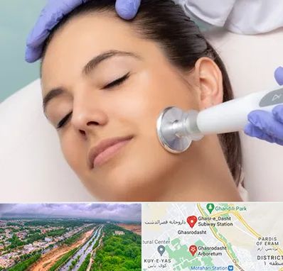 پلاسما جت در قصرالدشت شیراز