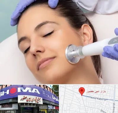 پلاسما جت در امین حضور