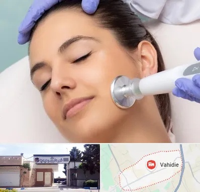 پلاسما جت در وحیدیه شهریار