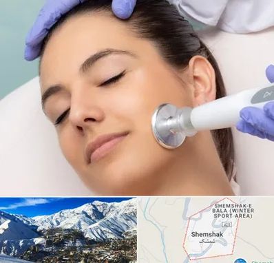 پلاسما جت در شمشک