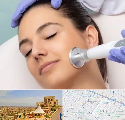 پلاسما جت در هاشمیه مشهد