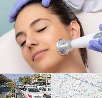 پلاسما جت در مفتح مشهد