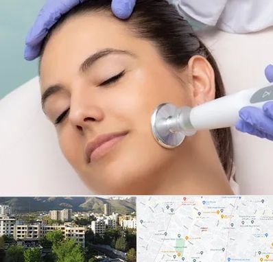 پلاسما جت در دیباجی