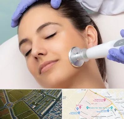 پلاسما جت در الهیه مشهد