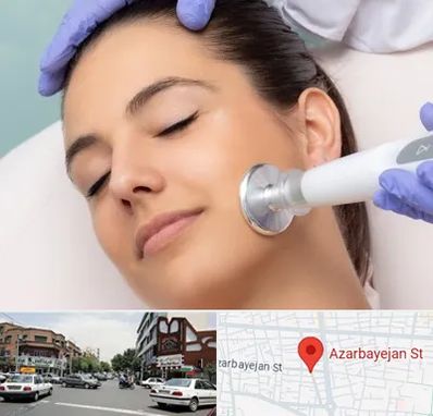 پلاسما جت در خیابان آذربایجان