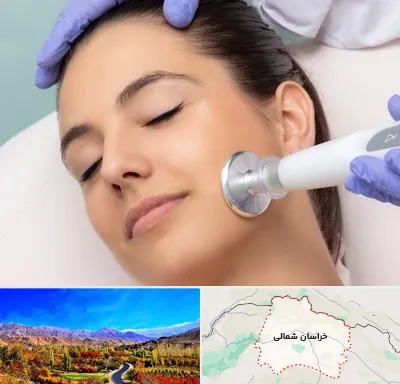 پلاسما جت در خراسان شمالی