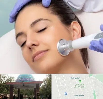 پلاسما جت در کیانشهر
