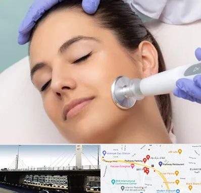 پلاسما جت در پارک وی