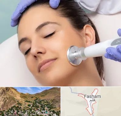 پلاسما جت در فشم