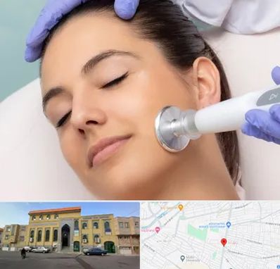 پلاسما جت در زنبیل آباد قم