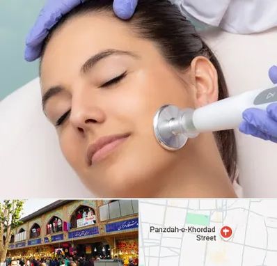 پلاسما جت در 15 خرداد