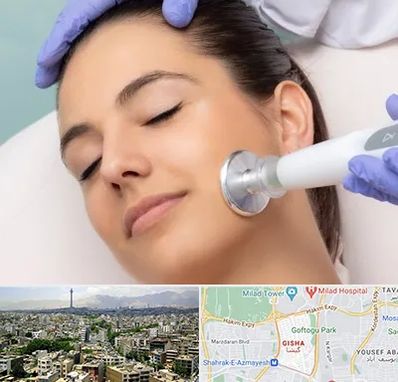 پلاسما جت در گیشا