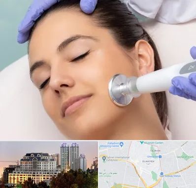 پلاسما جت در فرشته