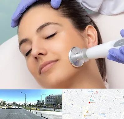 پلاسما جت در بلوار کلاهدوز مشهد