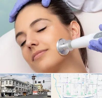 پلاسما جت در 17شهریور