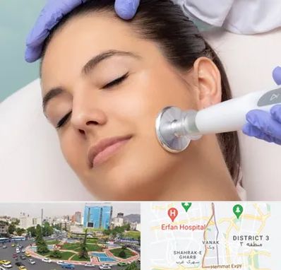 پلاسما جت در ونک تهران