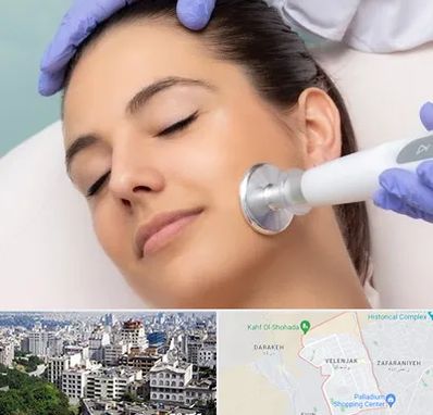 پلاسما جت در ولنجک