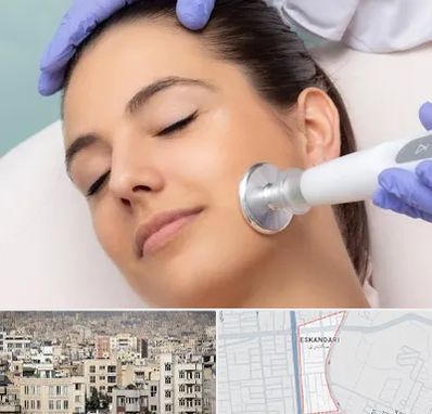 پلاسما جت در اسکندری