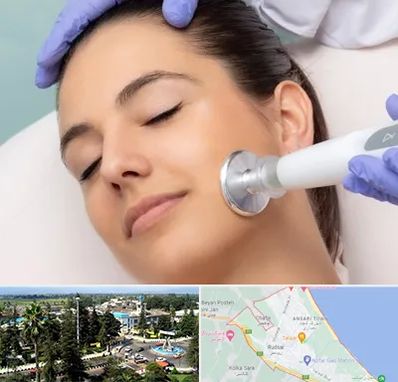 پلاسما جت در رودسر