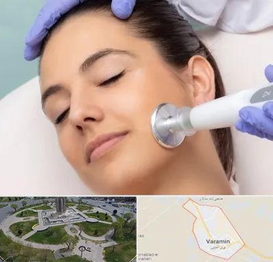 پلاسما جت در ورامین