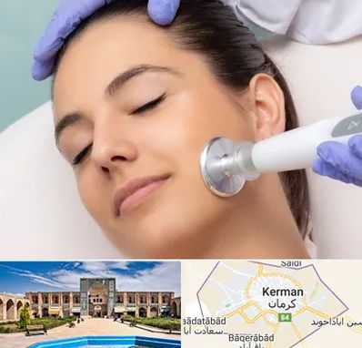 پلاسما جت در کرمان