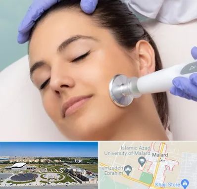 پلاسما جت در ملارد