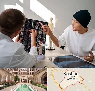 دکتر سرطان مغز در کاشان