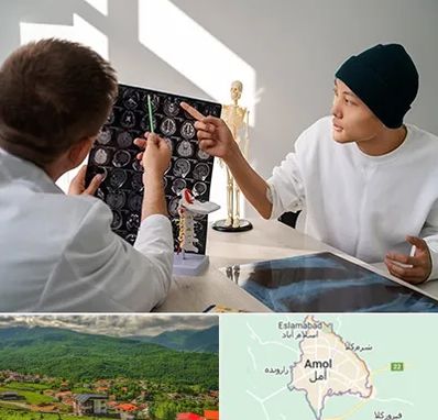 دکتر سرطان مغز در آمل