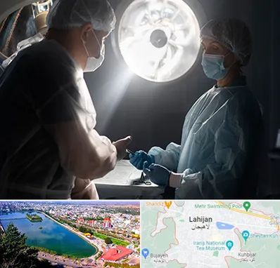 جراح سرطان مغز در لاهیجان