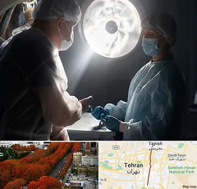 جراح سرطان مغز در ولیعصر 