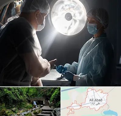 جراح سرطان مغز در علی آباد کتول