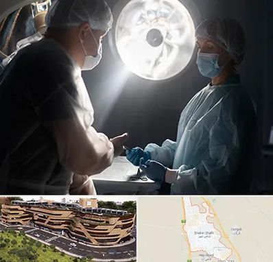 جراح سرطان مغز در شاهین شهر