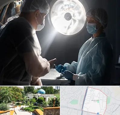 جراح سرطان مغز در باغمیشه تبریز