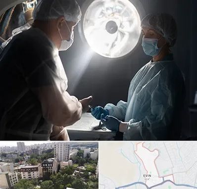 جراح سرطان مغز در اوین