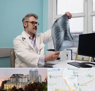 دکتر سرطان مغز و استخوان در فرشته 