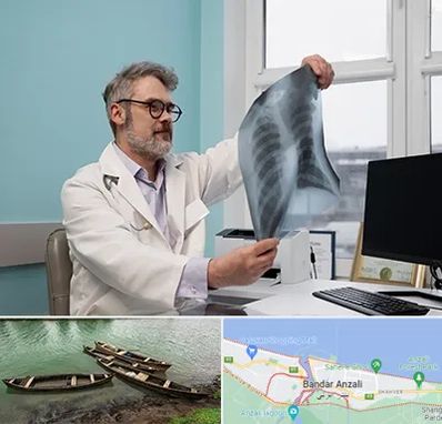 دکتر سرطان مغز و استخوان در بندر انزلی