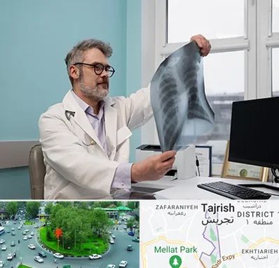 دکتر سرطان مغز و استخوان در تجریش 