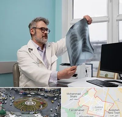 دکتر سرطان مغز و استخوان در فردیس کرج 