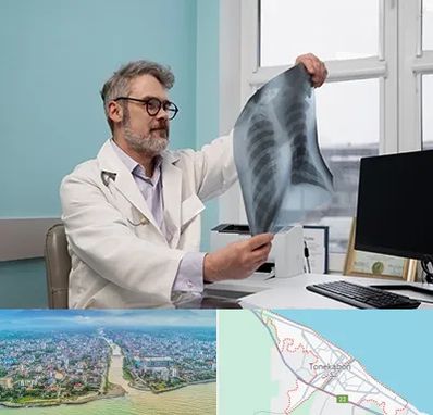 دکتر سرطان مغز و استخوان در تنکابن